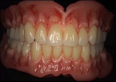 A close up photo of a set of dentures